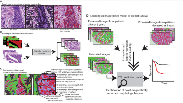 classic machine learning breast cancer detection